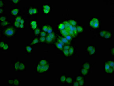 NMRAL1 Polyclonal Antibody - image 2
