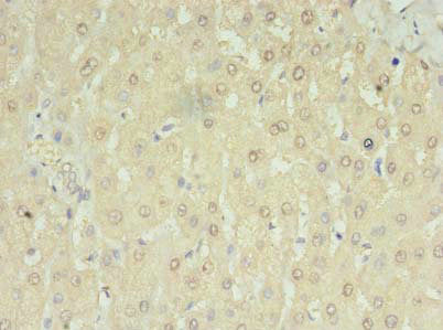 MRM3 Polyclonal Antibody - image 2