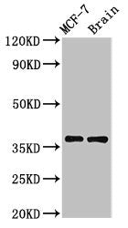 Immunohistochemistry of paraffin-embedded human liver cancer using CAC13484 at dilution of 1:100