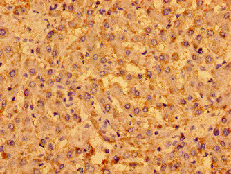 MENT Polyclonal Antibody - image 3