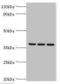 Immunohistochemistry of paraffin-embedded human lung cancer using CAC13493 at dilution of 1:100