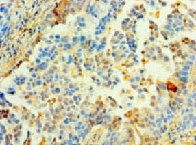 Immunohistochemistry of paraffin-embedded human adrenal gland tissue using CAC13493 at dilution of 1:100