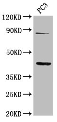 Immunofluorescence staining of HepG2 cells with CAC13499 at 1:200, counter-stained with DAPI. The cells were fixed in 4% formaldehyde, permeabilized using 0.2% Triton X-100 and blocked in 10% normal Goat Serum. The cells were then incubated with the antibody overnight at 4°C. The secondary antibody was Alexa Fluor 488-congugated AffiniPure Goat Anti-Rabbit IgG(H+L).