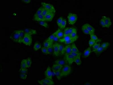 TNFRSF19 Polyclonal Antibody - image 3