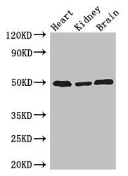 ANKRD10 Polyclonal Antibody - image 2