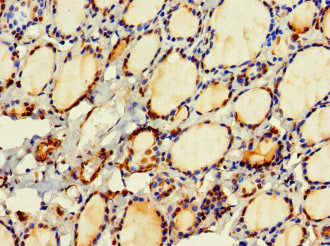 Immunofluorescent analysis of Hela cells using CAC13508 at dilution of 1:100 and Alexa Fluor 488-congugated AffiniPure Goat Anti-Rabbit IgG(H+L)