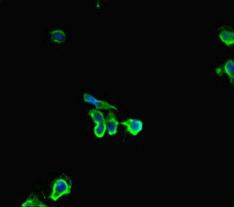 HDHD2 Polyclonal Antibody - image 3