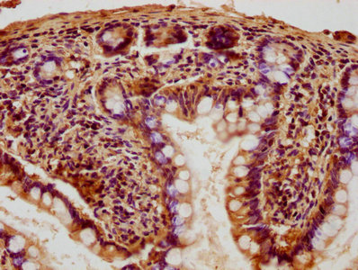 Immunofluorescence staining of PC-3 cells with CAC13515 at 1:50, counter-stained with DAPI. The cells were fixed in 4% formaldehyde, permeabilized using 0.2% Triton X-100 and blocked in 10% normal Goat Serum. The cells were then incubated with the antibody overnight at 4°C. The secondary antibody was Alexa Fluor 488-congugated AffiniPure Goat Anti-Rabbit IgG(H+L).