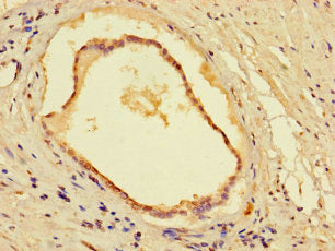Immunohistochemistry of paraffin-embedded human adrenal gland tissue using CAC13518 at dilution of 1:100