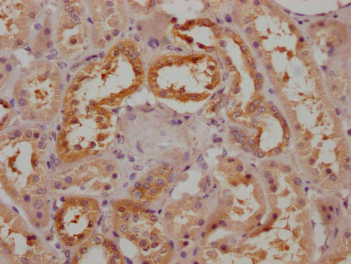 Immunofluorescence staining of MCF-7 cells with CAC13522 at 1:100, counter-stained with DAPI. The cells were fixed in 4% formaldehyde and blocked in 10% normal Goat Serum. The cells were then incubated with the antibody overnight at 4°C. The secondary antibody was Alexa Fluor 488-congugated AffiniPure Goat Anti-Rabbit IgG(H+L).