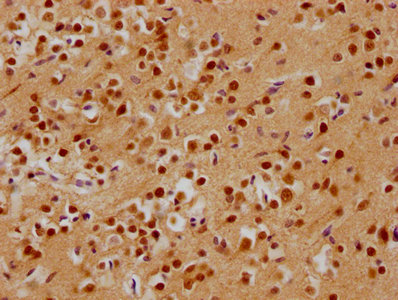 Western Blot, Positive WB detected in: U251 whole cell lysate, HL60 whole cell lysate, 293T whole cell lysate, All lanes: ADNP antibody at 1:2000, Secondary, Goat polyclonal to rabbit IgG at 1/50000 dilution, Predicted band size: 124 kDa, Observed band size: 135 kDa