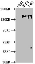 ADNP Polyclonal Antibody - image 3