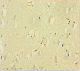 Immunofluorescent analysis of MCF-7 cells using CAC13543 at dilution of 1:100 and Alexa Fluor 488-congugated AffiniPure Goat Anti-Rabbit IgG(H+L)