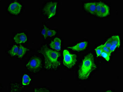 GABRQ Polyclonal Antibody - image 3