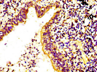 RPS6KA6 Polyclonal Antibody - image 2