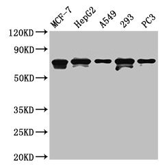 IHC image of CAC13546 diluted at 1:320 and staining in paraffin-embedded human testis tissue performed on a Leica BondTM system. After dewaxing and hydration, antigen retrieval was mediated by high pressure in a citrate buffer (pH 6.0). Section was blocked with 10% normal goat serum 30min at RT. Then primary antibody (1% BSA) was incubated at 4°C overnight. The primary is detected by a biotinylated secondary antibody and visualized using an HRP conjugated SP system.