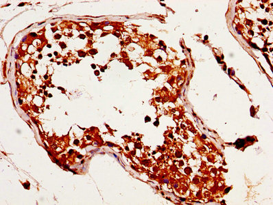 IHC image of CAC13546 diluted at 1:320 and staining in paraffin-embedded human adrenal gland tissue performed on a Leica BondTM system. After dewaxing and hydration, antigen retrieval was mediated by high pressure in a citrate buffer (pH 6.0). Section was blocked with 10% normal goat serum 30min at RT. Then primary antibody (1% BSA) was incubated at 4°C overnight. The primary is detected by a biotinylated secondary antibody and visualized using an HRP conjugated SP system.