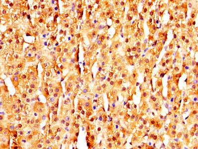 Immunofluorescence staining of Hela cells with CAC13546 at 1:145, counter-stained with DAPI. The cells were fixed in 4% formaldehyde, permeabilized using 0.2% Triton X-100 and blocked in 10% normal Goat Serum. The cells were then incubated with the antibody overnight at 4°C. The secondary antibody was Alexa Fluor 488-congugated AffiniPure Goat Anti-Rabbit IgG(H+L).