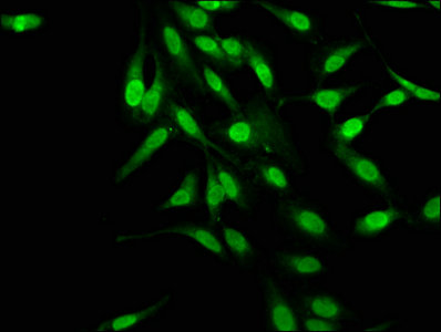 MAGED2 Polyclonal Antibody - image 5
