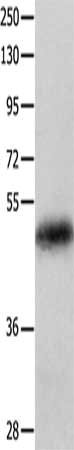 KRT23 Polyclonal Antibody - image 2