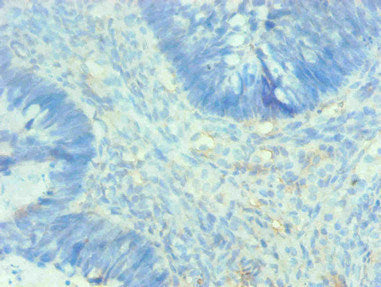 AHSG Monoclonal Antibody - image 3