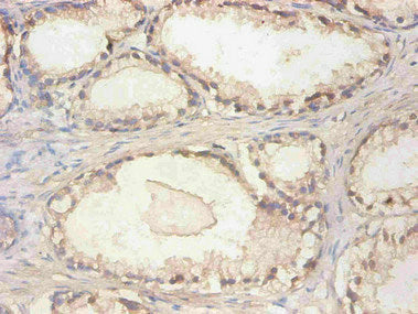 Immunohistochemical of paraffin-embedded human kidney tissue using CAC13657 at dilution of 1:200