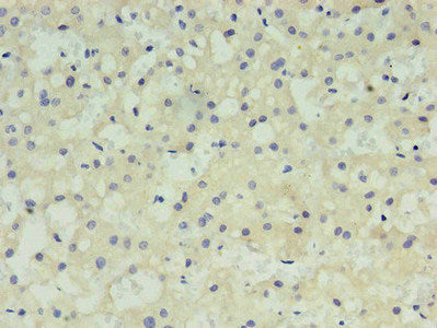 AFP Monoclonal Antibody - image 3