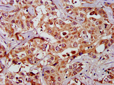 GAS2 Polyclonal Antibody - image 3