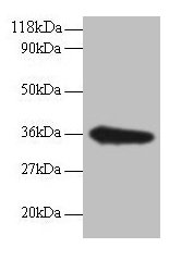 Immunofluorescent analysis of Hela cells using CAC13736 at dilution of 1:100 and Alexa Fluor 488-congugated AffiniPure Goat Anti-Rabbit IgG(H+L)
