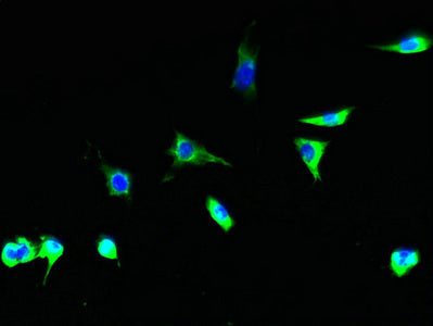 Immunohistochemistry of paraffin-embedded human kidney tissue using CAC13736 at dilution of 1:100