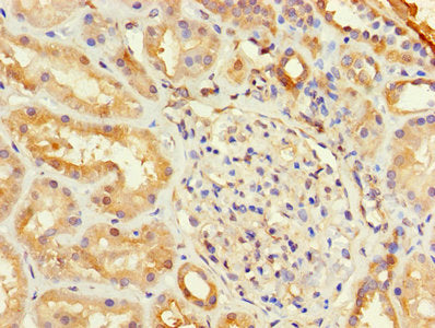 TSTA3 Polyclonal Antibody - image 4