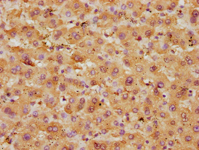 Western Blot, Positive WB detected in: HepG2 whole cell lysate, Mouse liver tissue, Mouse skeletal muscle tissue, All lanes: GOT1 antibody at 4.5ug/ml, Secondary, Goat polyclonal to rabbit IgG at 1/50000 dilution, Predicted band size: 47, 45 kDa, Observed band size: 47 kDa