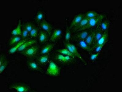 GOT1 Polyclonal Antibody - image 5