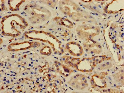 Immunofluorescent analysis of Hela cells using CAC13748 at dilution of 1:100 and Alexa Fluor 488-congugated AffiniPure Goat Anti-Rabbit IgG(H+L)