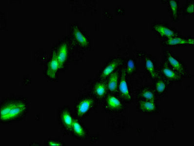 IHC image of CAC13748 diluted at 1:260 and staining in paraffin-embedded human lymph node tissue performed on a Leica BondTM system. After dewaxing and hydration, antigen retrieval was mediated by high pressure in a citrate buffer (pH 6.0). Section was blocked with 10% normal goat serum 30min at RT. Then primary antibody (1% BSA) was incubated at 4°C overnight. The primary is detected by a biotinylated secondary antibody and visualized using an HRP conjugated SP system.