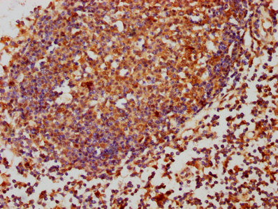 PPP2CB Polyclonal Antibody - image 5