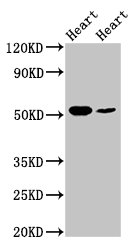 IHC image of CAC13754 diluted at 1:100 and staining in paraffin-embedded human skeletal muscle tissue performed on a Leica BondTM system. After dewaxing and hydration, antigen retrieval was mediated by high pressure in a citrate buffer (pH 6.0). Section was blocked with 10% normal goat serum 30min at RT. Then primary antibody (1% BSA) was incubated at 4°C overnight. The primary is detected by a biotinylated secondary antibody and visualized using an HRP conjugated SP system.