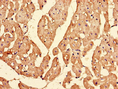 Immunofluorescent analysis of Hela cells using CAC13784 at dilution of 1:100 and Alexa Fluor 488-congugated AffiniPure Goat Anti-Rabbit IgG(H+L)