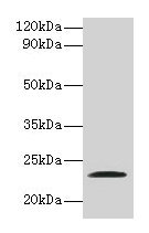 JAM2 Polyclonal Antibody - image 2