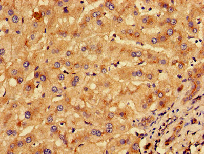 Immunofluorescent analysis of Hela cells using CAC13792 at dilution of 1:100 and Alexa Fluor 488-congugated AffiniPure Goat Anti-Rabbit IgG(H+L)