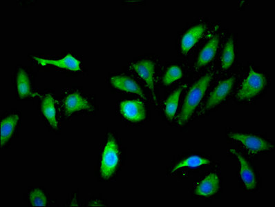 KLHL2 Polyclonal Antibody - image 4