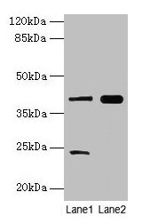 Immunohistochemistry of paraffin-embedded human skeletal muscle tissue using CAC13814 at dilution of 1:100