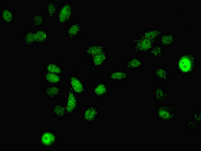 MAP2K3 Polyclonal Antibody - image 4