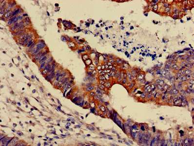 Immunofluorescence staining of HepG2 cells with CAC13817 at 1:200, counter-stained with DAPI. The cells were fixed in 4% formaldehyde, permeabilized using 0.2% Triton X-100 and blocked in 10% normal Goat Serum. The cells were then incubated with the antibody overnight at 4°C. The secondary antibody was Alexa Fluor 488-congugated AffiniPure Goat Anti-Rabbit IgG(H+L).