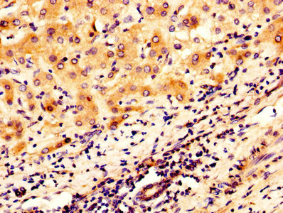 Immunofluorescence staining of HepG2 cells with CAC13851 at 1:100, counter-stained with DAPI. The cells were fixed in 4% formaldehyde, permeabilized using 0.2% Triton X-100 and blocked in 10% normal Goat Serum. The cells were then incubated with the antibody overnight at 4°C. The secondary antibody was Alexa Fluor 488-congugated AffiniPure Goat Anti-Rabbit IgG(H+L).