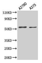 Immunohistochemistry of paraffin-embedded human skin tissue using CAC13856 at dilution of 1:100