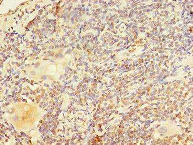 Immunofluorescent analysis of Hela cells using CAC13856 at dilution of 1:100 and Alexa Fluor 488-congugated AffiniPure Goat Anti-Rabbit IgG(H+L)