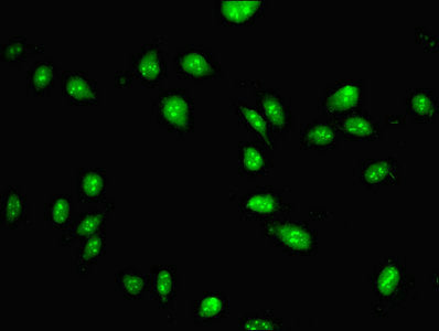 PAX3 Polyclonal Antibody - image 5