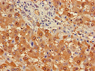 Immunohistochemistry of paraffin-embedded human testis tissue using CAC13862 at dilution of 1:100