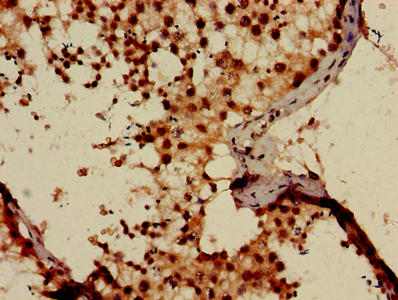 Immunofluorescent analysis of HepG2 cells using CAC13862 at dilution of 1:100 and Alexa Fluor 488-congugated AffiniPure Goat Anti-Rabbit IgG(H+L)